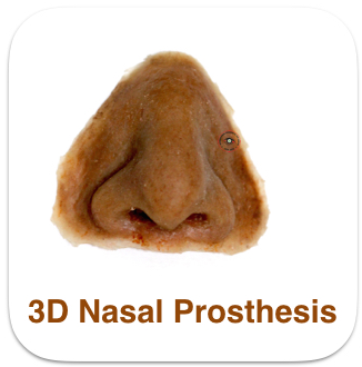 Nasal Prosthesis India